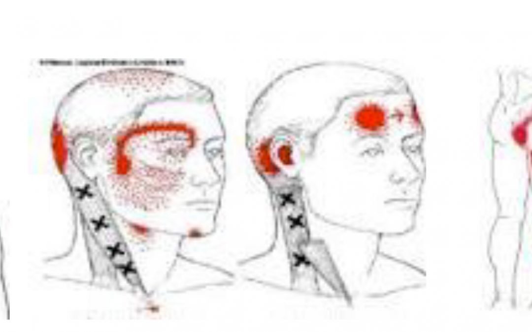 Polo Salute Lucca | Trigger points