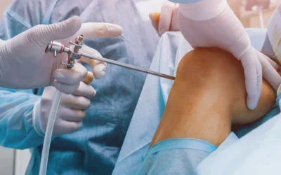 Meniscectomia: la fisioterapia fa la differenza nel recupero!