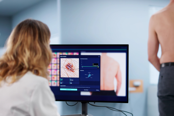 Polo Salute Lucca | Mappatura nevi digitalizzata