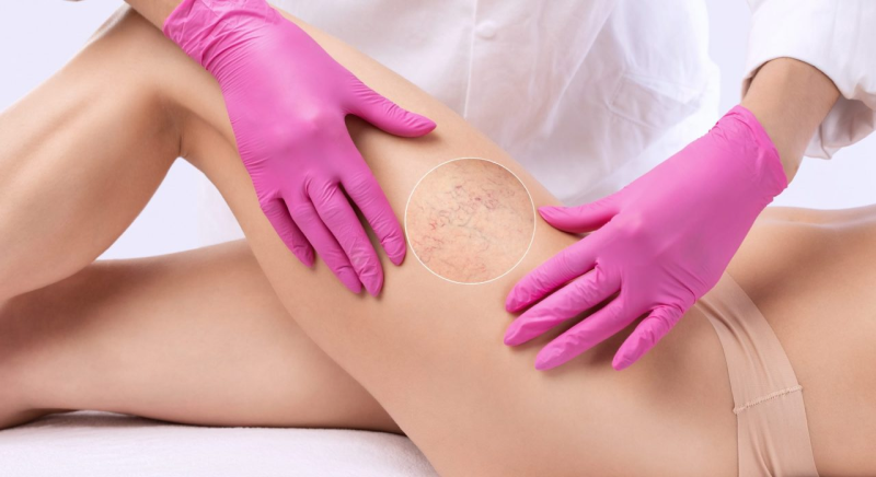 Polo Salute Lucca | Laserterapia estetica e dermatologica