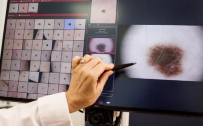 Polo Salute Lucca | Mappatura dei nei con FotoFinder: come funziona, chi dovrebbe farla e perché è uno degli strumenti più efficaci per la prevenzione del melanoma