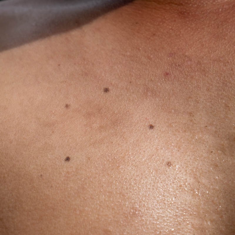 Polo Salute Lucca | Skin Clinic